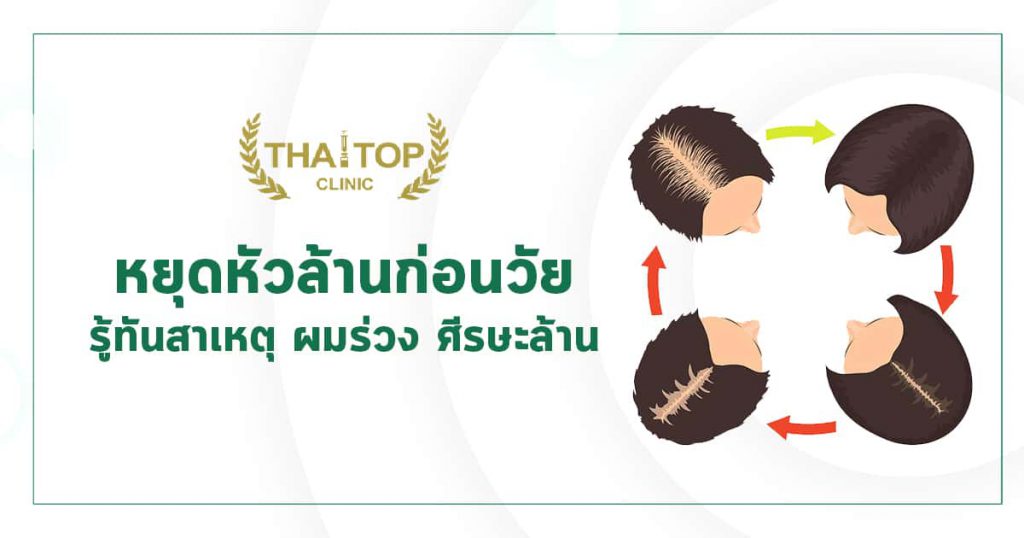ผมร่วง ทำไงดี