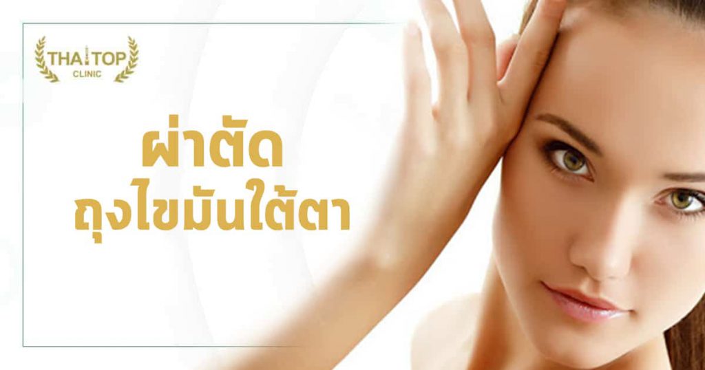 ผ่าตัดถุงไขมันใต้ตา